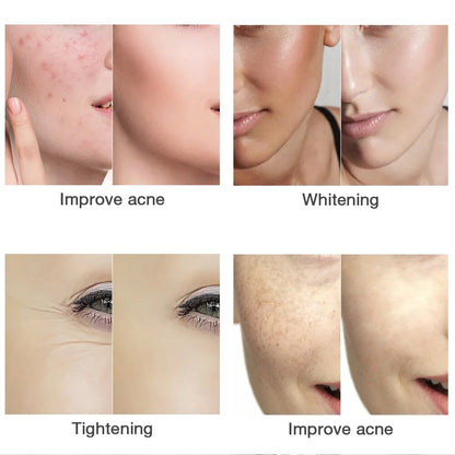 3 Colors LED Beauty Mask Face Treatment LED Light Therapy Mask Anti Acne Wrinkle Removal Photon Rejuvenation Skin Lifting Device